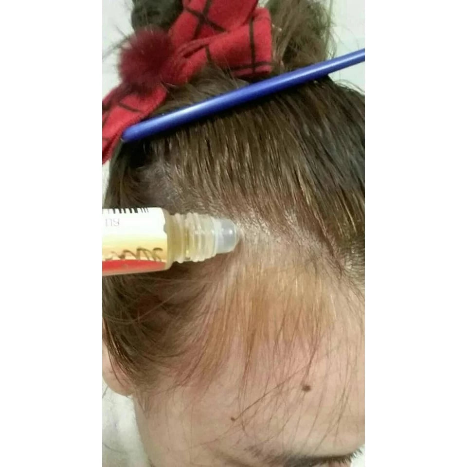 Genive Hair Growth Serum scalp hair application close up