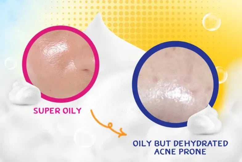 Clean Clear Foaming Wash skincare hydration and oil free cleansing concept image