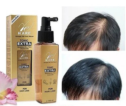 BIO WOMAN HAIR LOSS TONIC EXTRA STRENGTH TREATMENT FAST GROW REGROWTH REGROW