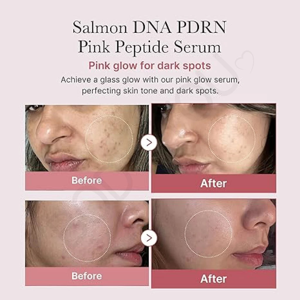 Medicube PDRN Pink Peptide Serum before and after results for dark spots and skin tone improvement