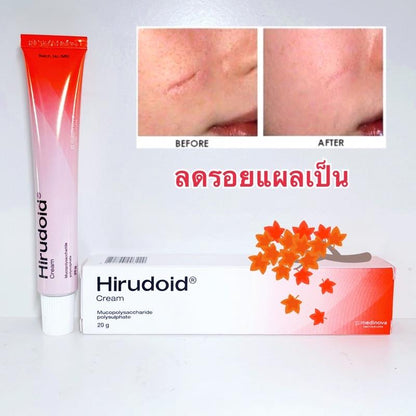 Hirudoid Cream 10g for Bruises Scars Swelling Inflammation and Burn Relief