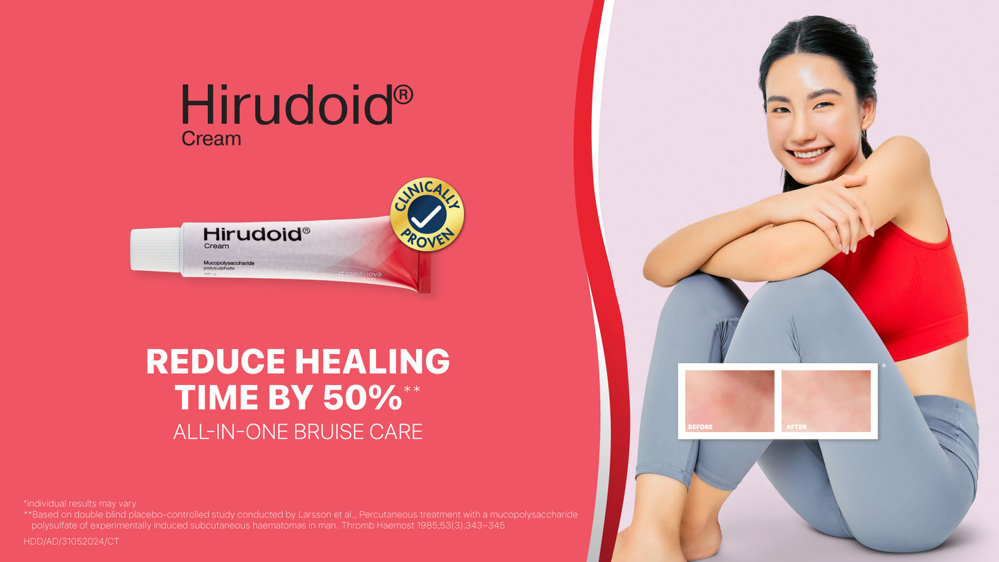 40g. HIRUDOID CREAM FOR SCARS BRUISES VARICOSE VEIN SKIN ANTI INFLAMMATION BURNS