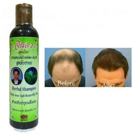 Jinda Herbal Shampoo before and after hair growth results photo comparison