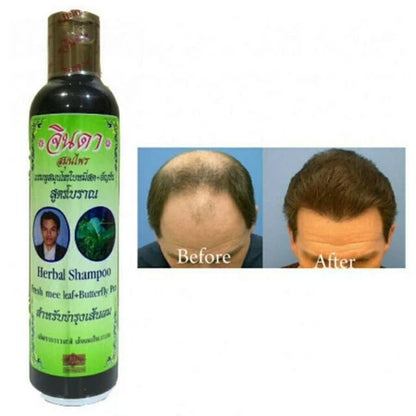 Jinda Herbal Shampoo before and after hair growth results photo comparison
