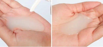 CLEAR Hair Fall Resist shampoo gel texture in a person's hand for scalp care.
