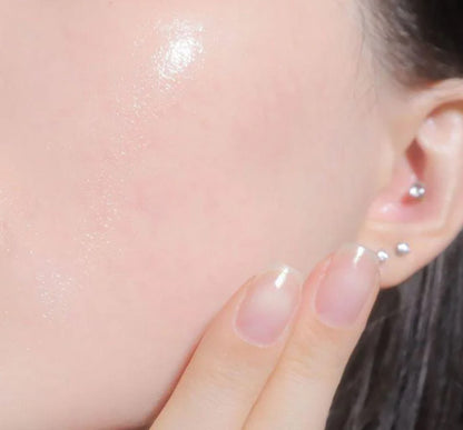 Provamed Retinol-A Acne Gel applied on cheek skin for acne spot treatment