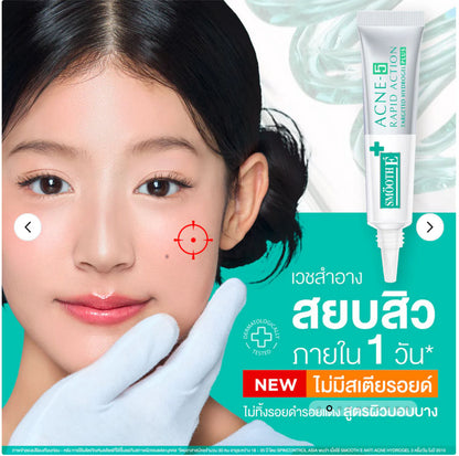 Smooth E Acne Hydrogel Plus skincare model holding product clean skin concept