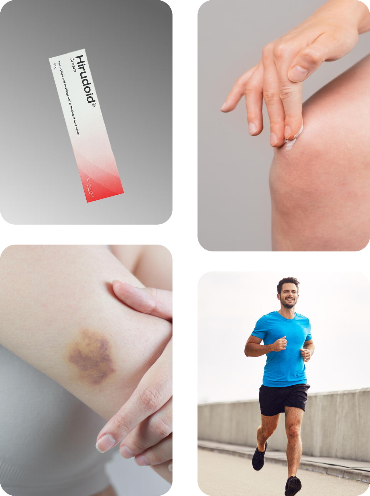 40g. HIRUDOID CREAM FOR SCARS BRUISES VARICOSE VEIN SKIN ANTI INFLAMMATION BURNS