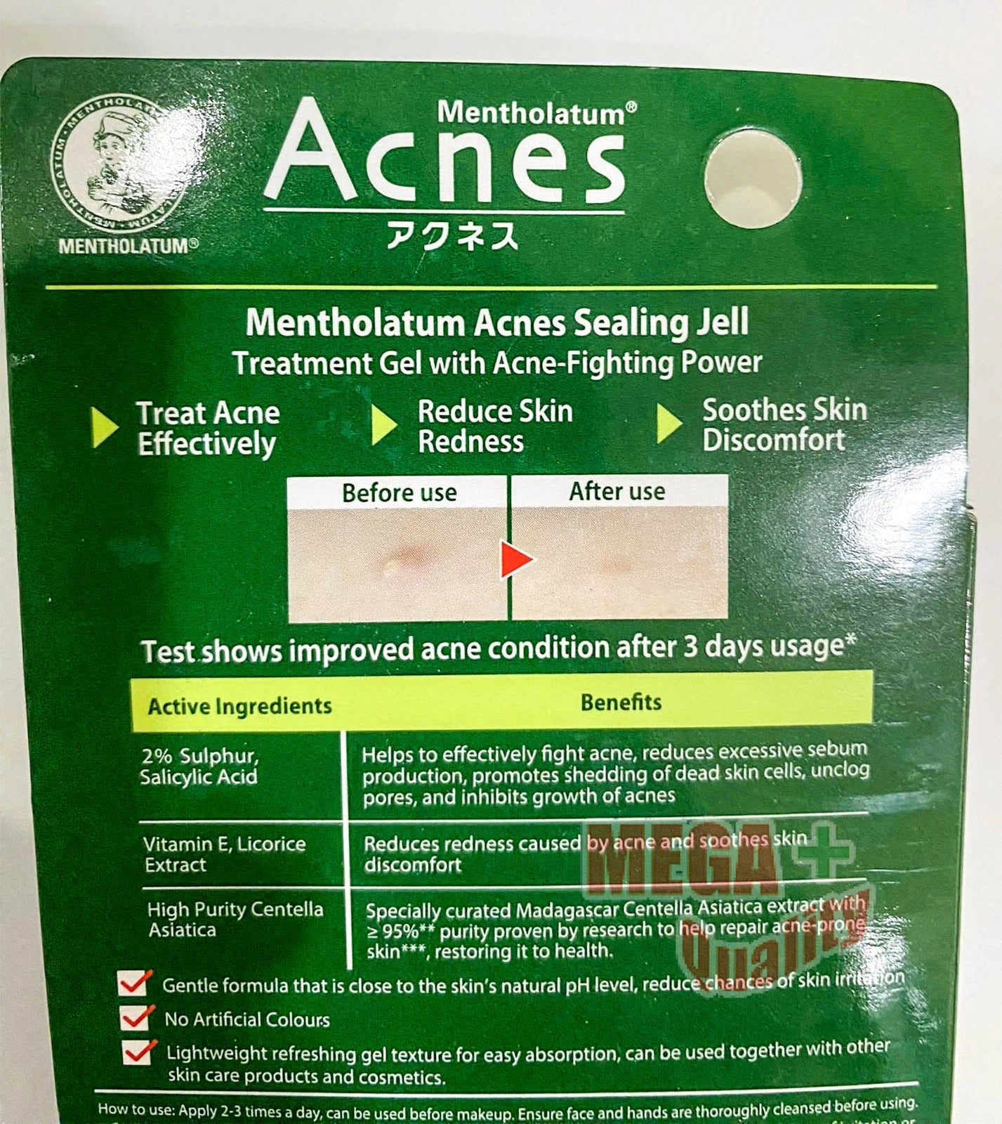 Mentholatum Acnes Sealing Jell acne care gel 18g packaging front view