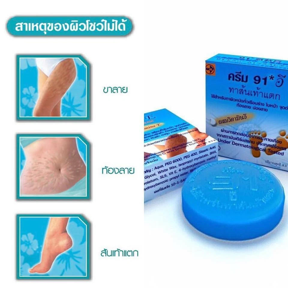 Cream 91 E Cracked Heel usage steps showing application on heels and feet