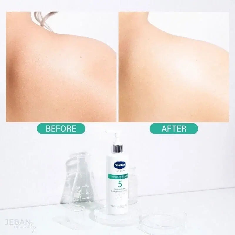 Vaseline Pro Derma 5 AHA body lotion before and after skin texture comparison on shoulder and neck.