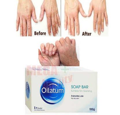 OILATUM SOAP BAR DRY SKIN gentle cleanser for dry sensitive skin family daily use