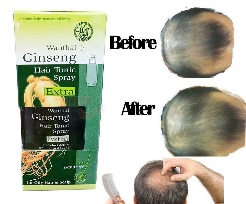 Wanthai Ginseng Hair Tonic Spray Extra 100ml product before and after dandruff treatment results