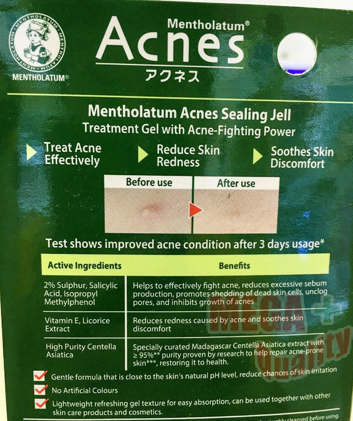 Detailed label of Mentholatum Acnes Sealing Jell highlighting acne treatment claims and usage instructions