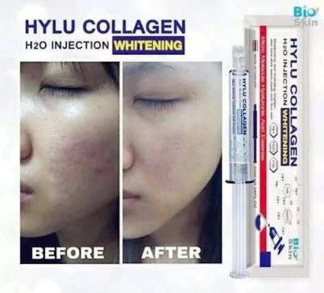 PWP Hylu Collagen Serum before and after comparison showing improved brightness and smoother skin texture