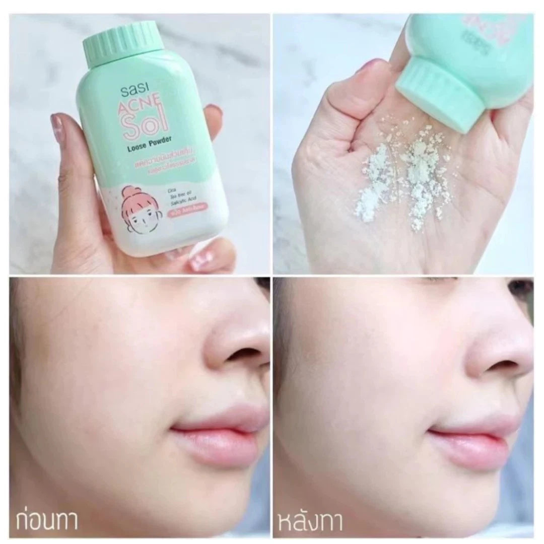 Sasi Acne Sol Loose Powder before after skin look comparison
