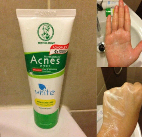 Mentholatum Acnes Face Wash usage demonstration hand applying cleanser