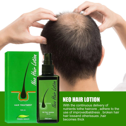 Application of Neo Hair Lotion 120ml spray on scalp for hair regrowth
