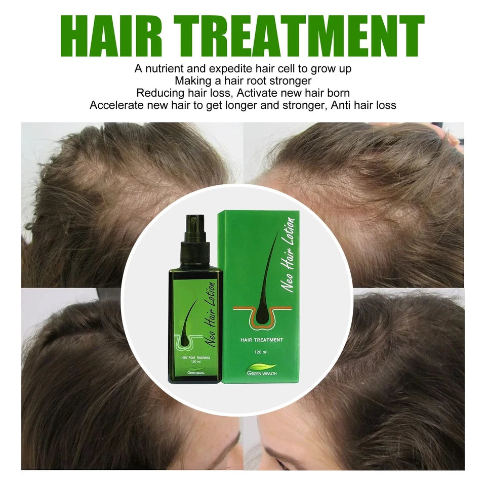Neo Hair Lotion 120ml Green Wealth hair treatment spray with scalp close-up