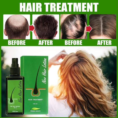 Hair treatment before and after results using Neo Hair Lotion 120ml