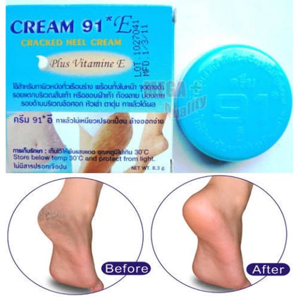 Cream 91 E Cracked Heel product with before and after heel images