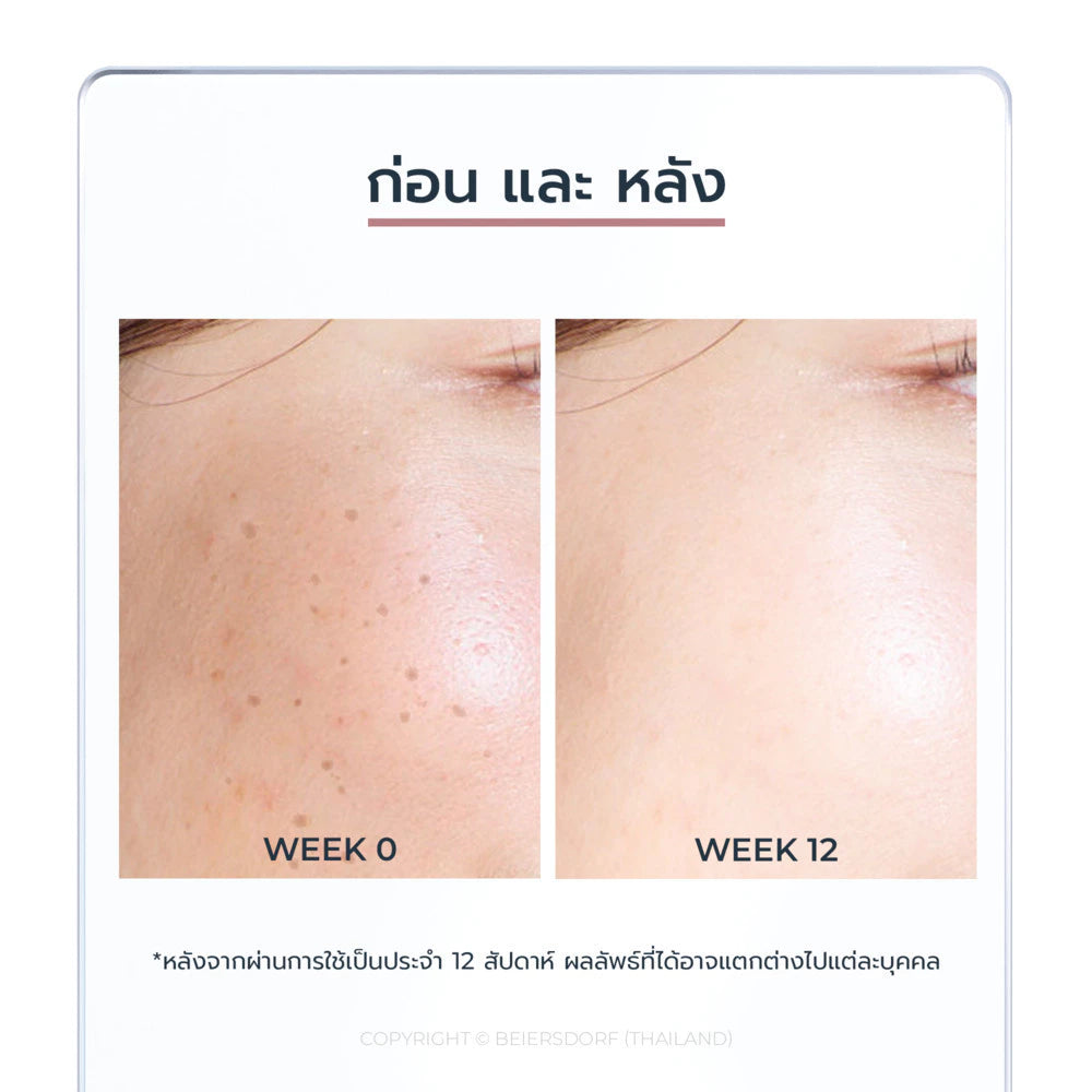 Eucerin Spotless Cleanser Brightening Foam Skin Before and After Results