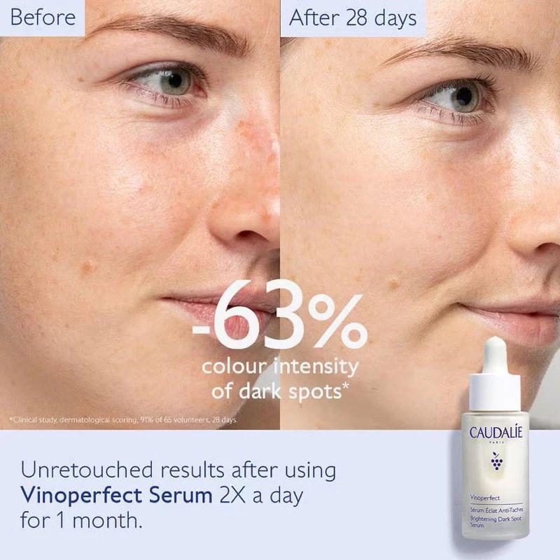 Before and after dark spot improvement graphic featuring Caudalie Vinoperfect Serum