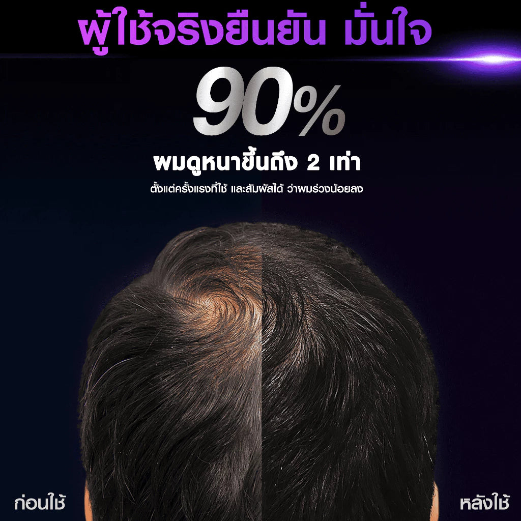 Clear Men Scalp Pro Serum before after hair result image