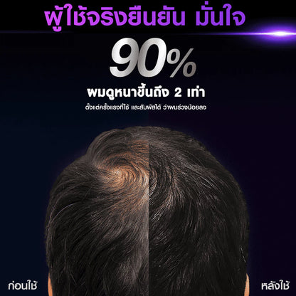 Clear Men Scalp Pro Serum before after hair result image