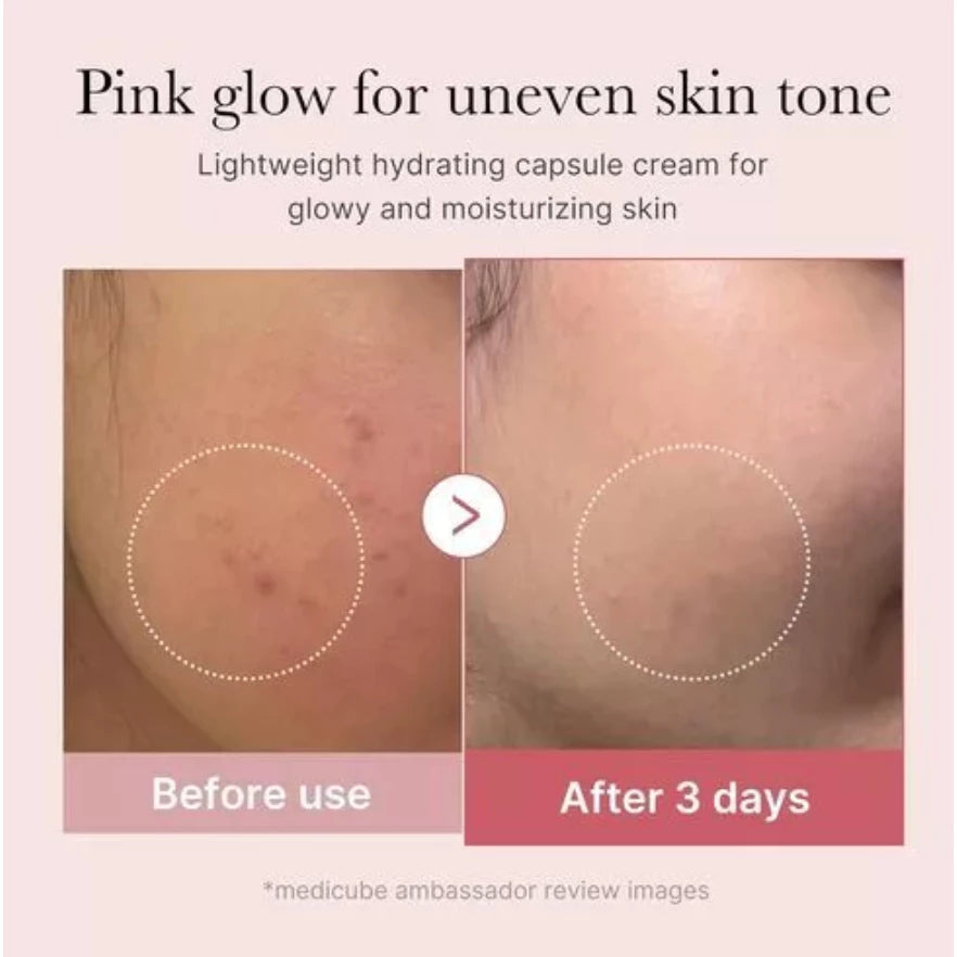 Medicube PDRN Pink Collagen Capsule Cream before and after skin improvement results
