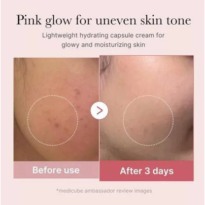 Medicube PDRN Pink Collagen Capsule Cream before and after skin improvement results